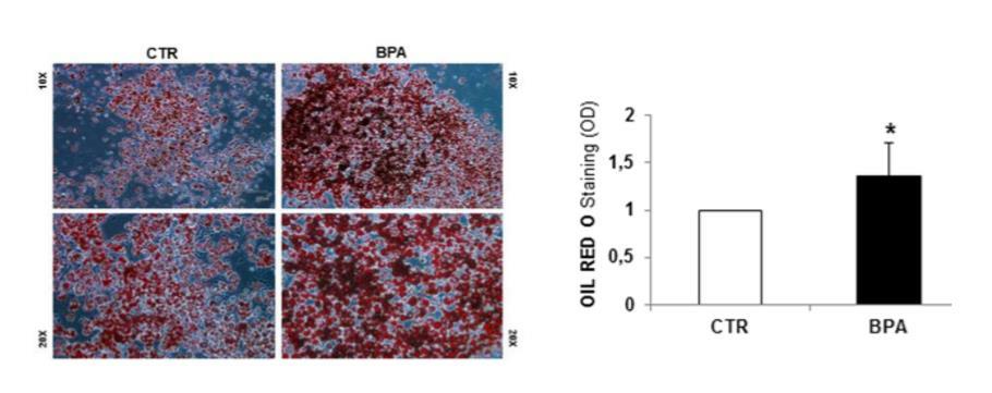 Interferenti endocrini : BPA e obesit&agrave; - Sifa Formazione