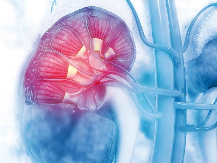La terapia dietetica mirata dell’Insufficienza Renale Cronica