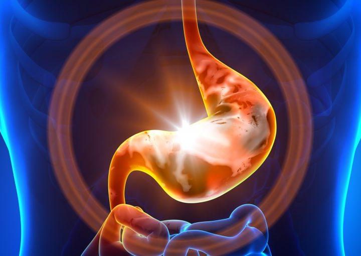 FARMACI GASTROPROTETTORI