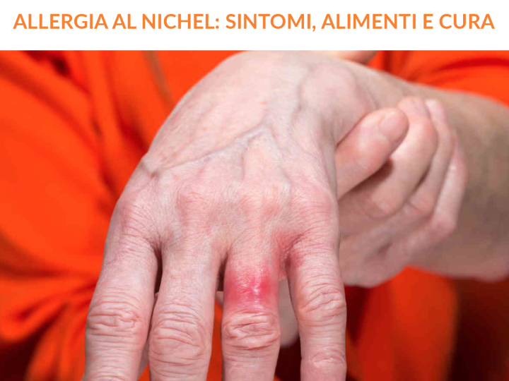 ALLERGIA AL NICHEL: SINTOMI, ALIMENTI E CURA